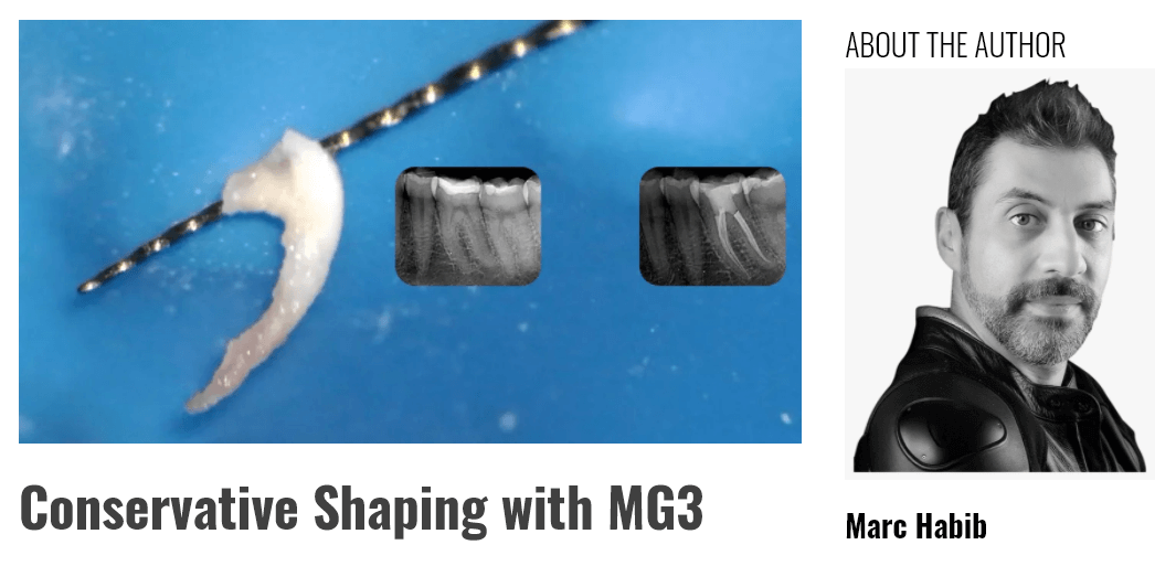 http://endodontics.styleitaliano.org/conservative-shaping-with-mg3/?fbclid=IwAR077Z0HS6V2_qG9bS2mwELl4t5YZ3qTRwF4U1u7rorOqIZgjiECr0eXOEA