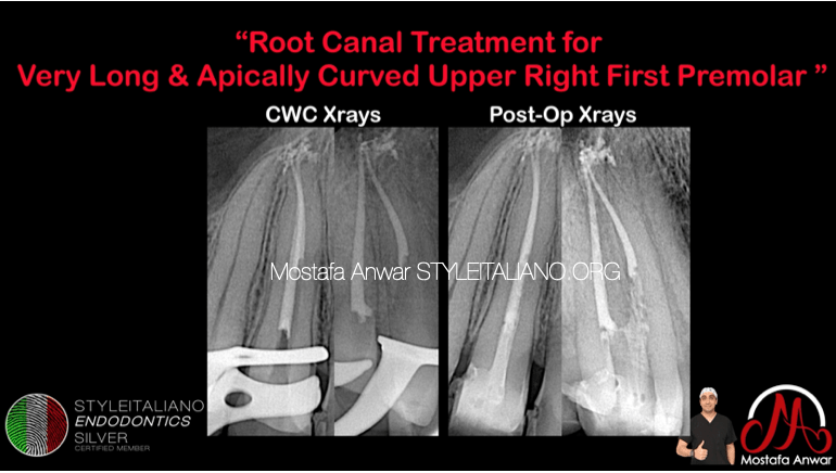 Post-operative Radiographs.